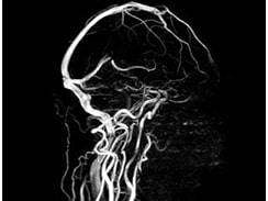 MRI検査の画像3