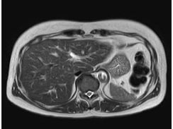 MRI検査の画像5